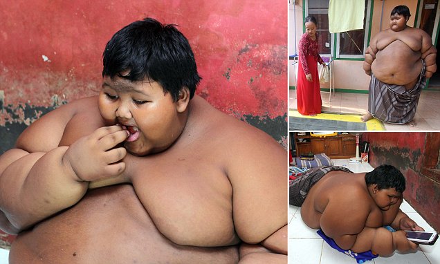 Bocah 192 Kg dari Karawang Disebut `MailOnline` Anak Tergendut Sejagat